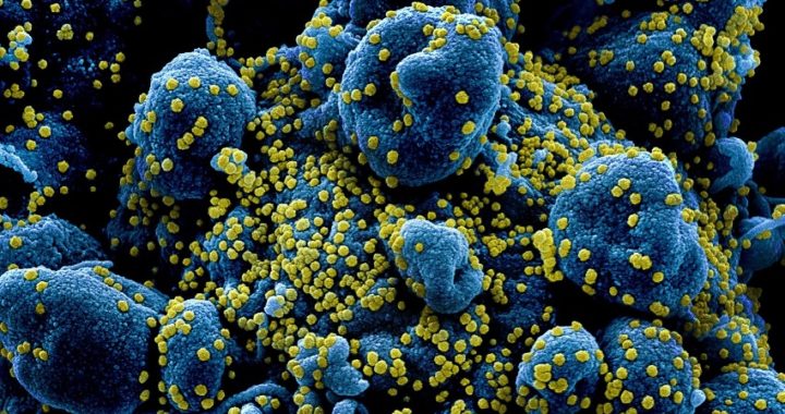 Coronavirus: mutante, pero no necesariamente más virulento