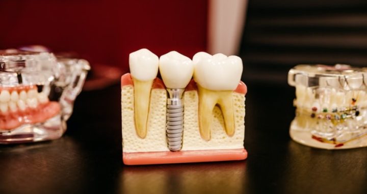 ¿Cuáles son los servicios más demandados que podemos encontrar en una clínica dental en Madrid?