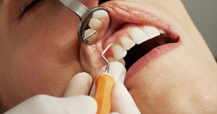 La importancia de acudir de forma regular al dentista